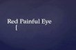 { Red Painful Eye. Anatomy Red painfull Eye 1- Conjectivitis 2-Kertitis 3-Uveitis –Iritis –Iridocyclitis 4-Acute congestive glaucoma Conjecivitis(all.