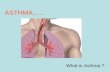 ASTHMA….. What is Asthma ?. WHAT IS ASTHMA? Asthma (AZ-ma) is a chronic (long- term) lung disease that inflames and narrows the airways.