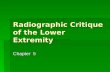Radiographic Critique of the Lower Extremity Chapter 5.