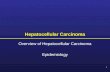 1 Hepatocellular Carcinoma Overview of Hepatocellular Carcinoma Epidemiology.