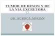 DR. SCROCA ADRIAN TUMOR DE RINON Y DE LA VIA EXCRETORA.
