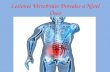 Lesiones Vertebrales Dorsales a Nivel Óseo. ¿Qué es la columna vertebral? La columna vertebral, raquis o espina dorsal es una compleja estructura osteofibrocartilaginosa.