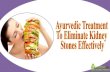 Ayurvedic Treatment To Eliminate Kidney Stones Effectively