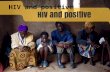 HIV and positive