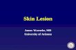 Skin Lesion