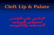 Cleft Lip & Palate
