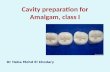 Cavity  preparation  for Amalgam, class I