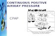 Continuous Positive Airway Pressure