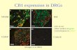 CB1 expression in DRGs