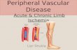 Peripheral Vascular  Disease  Acute & Chronic Limb Ischemia