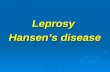 Leprosy  Hansen’s disease