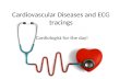 Cardiovascular Diseases and ECG tracings