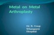 Metal  on  Metal  Arthroplasty