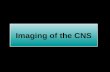 Imaging of the CNS