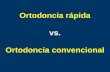 Ortodoncia rápida vs. Ortodoncia convencional