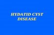 HYDATID CYST DISEASE
