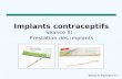 Implants  contraceptifs