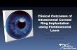 Clinical Outcomes of Intrastromal Corneal Ring Implantation using Femtosecond Laser