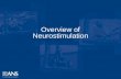 Overview of Neurostimulation