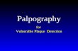 Palpography for  Vulnerable Plaque  Detection