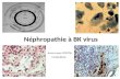 Néphropathie à BK virus