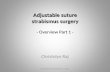 Adjustable suture strabismus surgery - Overview Part 1 -