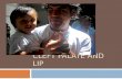 Cleft Palate and Lip