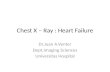Chest X – Ray : Heart  Failure