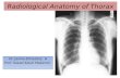 Radiological Anatomy of Thorax