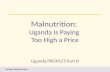 Malnutrition:  Uganda Is Paying  Too High a Price