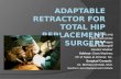 Adaptable Retractor for Total Hip Replacement Surgery