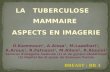 LA   TUBERCULOSE   MAMMAIRE  ASPECTS EN IMAGERIE