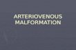 ARTERIOVENOUS  MALFORMATION