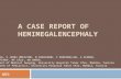 A CASE REPORT OF HEMIMEGALENCEPHALY