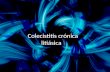Colecistitis crónica litiásica