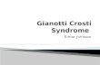 Gianotti Crosti  Syndrome
