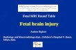Fetal MRI Round Table