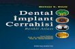 Dental Implant Cerrahisi