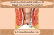 Use Hemorrhoids Herbal Treatment To Reduce Pain, Swelling And Irritation