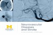 Neurovascular Diseases and Stroke