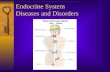 Endocrine System Diseases and Disorders. Gigantism  hyper GH before 25  extreme skeletal size.