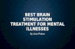 BEST BRAIN STIMULATION TREATMENT FOR MENTAL ILLNESSES By Liam Phelan.