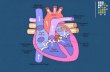 HEART PHYSIOLOGY (HOW THE HEART WORKS) HEART SOUNDS.