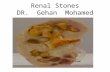 Renal Stones DR. Gehan Mohamed. Learning objectives 1- define renal stones and know the alternative names. 2- understand the causes and risk factors for.