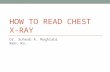 HOW TO READ CHEST X-RAY Dr. Suheab A. Maghrabi MBBS, MSc.