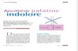 Anesthésie Palatine Indolore Inform Dent