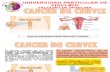 Seminario Cancer Cervix