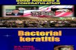 Bacteril Keratitis