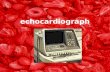 echocardiograph indah