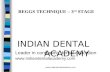 Begg Stage -3 Ortho / orthodontic courses by Indian dental academy